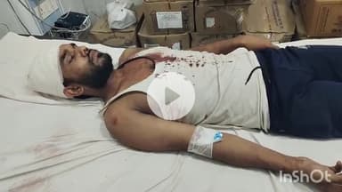 भीलवाड़ा: मंडपिया में मामूली कहासुनी के चलते युवक पर डंडों से हमला, घायल युवक का अस्पताल में इलाज जारी