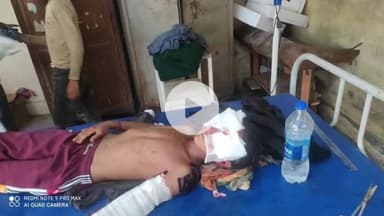 नारायणबगड़: नारायणबगड़ ब्लॉक के पैंतोली गांव में चारापत्ती लेने गए 10 वर्षीय बालक पर भालू ने किया हमला, हायर सेंटर रेफर