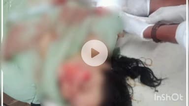 जगदलपुर: जगदलपुर नए पुल के पास स्कूल जा रही अतिथि शिक्षिका को अज्ञात वाहन ने मारी टक्कर, शिक्षिका का हाथ कटकर हुआ अलग