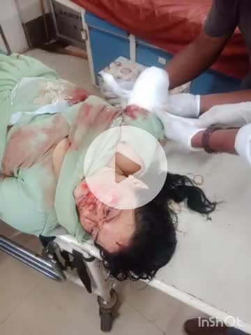 जगदलपुर: NH30 नया पुलिया के पास अज्ञात बस ने शिक्षिका को मारी ठोकर, हादसे में दाहिना हाथ काटकर हुआ अलग, रायपुर किया गया रिफर