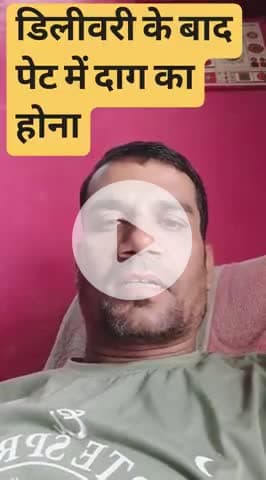 Strech marks
 #strechmarkremoval #strechmarksolution #strechmarkcream #StrechmarkproblemRemover