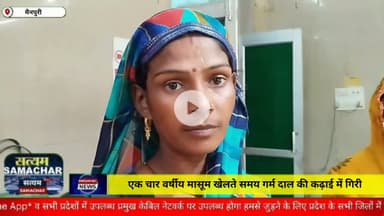 एक चार वर्षीय मासूम खेलते समय गर्म दाल की कढ़ाई में गिरी