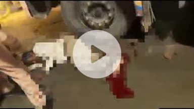 बलरामपुर: वीर विनय चौराहे पर सड़क हादसे में ट्रक के नीचे आया पीआरडी जवान, दोनों पैर गंभीर रूप से जख्मी, अस्पताल में चल रहा इलाज