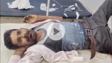 छिबरामऊ: नकटपुर रोड पर क्रॉस करते समय तेज रफ्तार अज्ञात वाहन ने बाइक में मारी टक्कर, दो युवक घायल, भर्ती कर रेफर किया गया