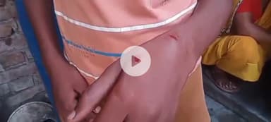 इटावा: सुन्दरपुर में पागल कुत्ते के आतंक से स्कूली बच्चे और ग्रामीण भयभीत, एक छात्र को काटकर किया गंभीर घायल