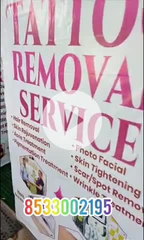 अलीगढ़: अमीर निशा मार्केट में टैटू रिमूवल सर्विस चालू हो गई है आपको नौकरी लगने में परेशानी आ रही है तो जरूर आएं #news