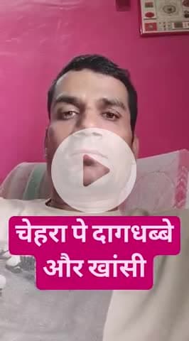 चेहरा पे दाग और खांसी
 #FaceGlowTips #khansi
 #faceglowing #faceglownaturally #FaceGlowUp @face Fresh  #FaceGlowTreat