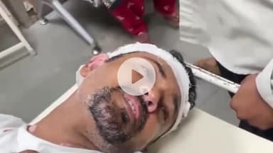 કરજણ: કરજન જલારામ નગરમા રહેતા બે ભાઈઓને ફળીયાના ઈસમોએ મારમારતા SSG મા સારવાર માટે ખસેડાયા