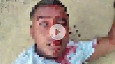 बाह: पिनाहट में जमीनी विवाद के दौरान लाठी-डंडा और कुल्हाड़ी से हमला, तीन लोग गंभीर घायल