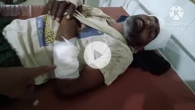 करमऊ में आंधी रात सोए घर में घुसे पांच चोर,चोरों ने घर के मलिक पर किया हमला, घायल जिला अस्पताल में भर्ती #karmau #satna