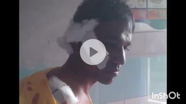 धार: धार जिले के मांडू में कुत्तों का आतंक, आवारा कुत्तों के झुंड ने बाइक सवार पर किया हमला, गंभीर रूप से घायल