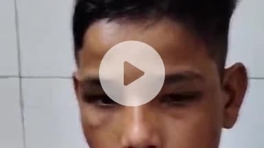 फतेहाबाद: फतेहाबाद के ग्राम महारामपुरा में मकान के सामने से गिट्टियां उठाने से मना करने पर हुई मारपीट, तीन घायल