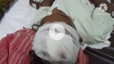 जगतदेव में फुल्की के ठेले पर युवक से तीन आरोपियों ने की मारपीट, शिकायत लेकर पहुंची मां भी पीटी, अस्पताल में भर्ती