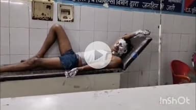 कोल: कलुआ में पुरानी कहासुनी को लेकर दबंग ने युवक पर डाला पेट्रोल, पास में खड़े होकर जला दी बीड़ी, युवक बुरी तरह झुलसा