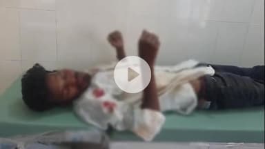 लोहरदगा: किस्को में भीषण सड़क हादसे में दो युवक गंभीर रूप से घायल, लोगों ने कहा- नशे में बाइक चलाने से हुई दुर्घटना