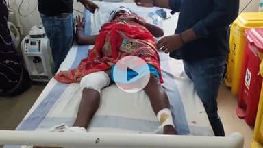 सासाराम: सासाराम एसपी जैन कॉलेज मोड़ के पास बाइक ने एक महिला को मारी टक्कर, महिला हुई जख्मी