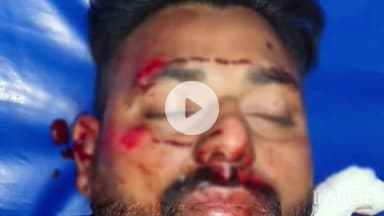 धरमपुरी: मधुबन चौराहे के पास अज्ञात वाहन ने बाइक सवार को मारी टक्कर, प्राथमिक उपचार के बाद किया रेफर