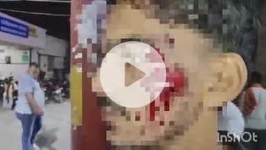 बहराइच: छावनी इलाके के पास बाजार जा रहे तीन युवकों पर दबंगों ने किया हमला, तीन युवक हुए घायल, पुलिस जांच में जुटी