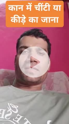 कान में चींटी 
 #ear  #insectinear
 #insectinside #earcare #earwealth
 @EarAi Centers #EAR
 #healthcare