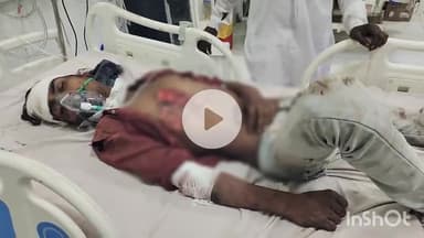 भीलवाड़ा: सिंगोली चारभुजा के पास तेज रफ्तार ट्रोले ने बाइक को मारी टक्कर, हादसे में बाइक सवार दो चचेरे भाई गंभीर घायल