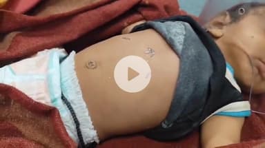 झाबुआ: झाबुआ में अंधविश्वास के चलते बेजुबान बच्चों को इलाज के नाम पर गर्म लोहे से दागा गया