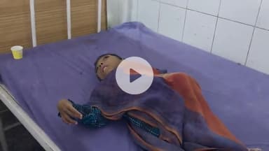 पूरनपुर: गोपालपुर के छप्परपोश घर में सो रहे मासूम पर अज्ञात जानवर का हमला, किया गया जिला अस्पताल रेफर