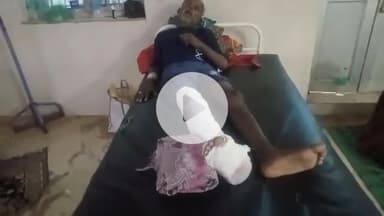 गोपद बनास: सीधी जिले के जोगीपुर में तेज रफ्तार ऑटो पलटा, हादसे में एक व्यक्ति का पैर फ्रैक्चर