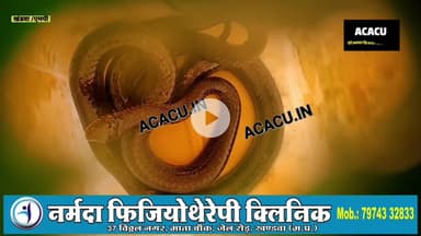 सांप पकड़ने वाले को सांप नें काटा. सांप लेकर पहुंचा हॉस्पिटल. इलाज जारी..