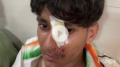 धरमपुरी: धरमपुरी से होशंगाबाद जा रही खिलाड़ियों की गाड़ी दुर्घटनाग्रस्त, 18 सितंबर को हुआ था हादसा