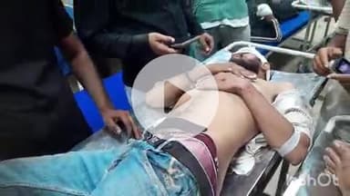 हाथरस: हाथरस जंक्शन के रेलवे स्टेशन के पास दो बाइकों की टक्कर में तीन लोग गंभीर रूप से घायल, जिला अस्पताल में उपचार जारी