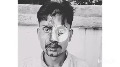 कलान: ग्राम दमुलिया में 2 पक्षों में हुई मारपीट, दोनों तरफ से 3 लोग हुए घायल