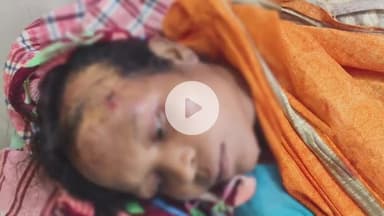 किस्को: किस्को में जंगली भालू के हमले से महिला घायल, प्राथमिक उपचार के बाद सदर अस्पताल रेफर