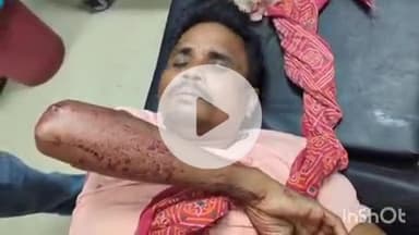 आरा: बभनौली गांव स्थित हाई स्कूल के समीप पूर्व के विवाद में जेल से जमानत पर बाहर एक युवक को गोली मारी गई