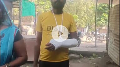 प्रतापगढ़: दुर्गा पूजा पंडाल में गए पुरानी पट्टी मोहल्ला के युवक की पीटाई, हाथ तोड़ने का आरोप