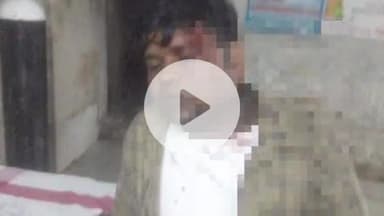 असरगंज: असरगंज बाजार में बदमाशों ने पति-पत्नी के साथ मारपीट और छिनतई की, पति-पत्नी घायल, मामला दर्ज