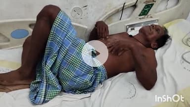 सासाराम: बासा गांव के एक किसान को मधुमक्खी ने काटकर किया जख्मी