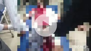 हाथरस: नाई का नगला में पति-पत्नी के बीच झगड़े के बाद पति ने चाकू से खुद पर किया प्रहार, जिला अस्पताल से आगरा हुआ रेफर