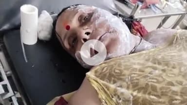आरा: शीशमहल चौक हरखेन धर्मशाला के समीप मंदिर में आरती दिखाने के दौरान महिला का शरीर 90 प्रतिशत जल गया