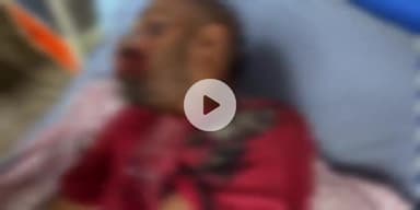 बागपत: दिल्ली-देहरादून एक्सप्रेस-वे पर गड्ढे में बाइक गिरने और फिसलने से टटीरी के दो युवक हुए घायल