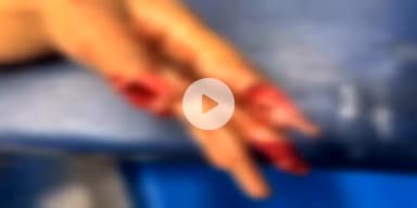 बागपत: कस्बा टटीरी में एक महिला पर अचानक जर्जर मकान का छज्जा टूटकर गिरने से महिला गंभीर रूप से घायल हुई