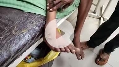 हाथरस: मोहल्ला आदर्श नगर में रामनवमी के दिन प्रसादी खाने गए कई बच्चों को लगा करंट, परिजन बच्चों को लेकर पहुंचे जिला अस्पताल