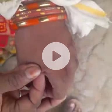 बाह: खेड़ा देवी दास गांव में महिला को सांप ने डसा, सीएचसी में इलाज जारी है