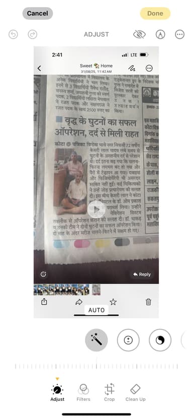 नवीगेशन  तकनीक से दोनों घुटने का सफल  ऑपरेशन