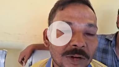 मुरादाबाद: मझोला थाना पुलिस ने मारपीट के दौरान जान से मारने की नीयत से हमला करने वाले आरोपी को गिरफ्तार कर जेल भेजा