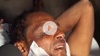 बहराइच: मेडिकल कॉलेज में भर्ती हिंसक वन्य जीव के हमले में घायल पीड़ित ने बताई आपबीती, हमला करने वाले जानवर को उतारा मौत के घाट