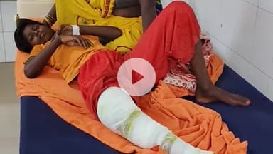 पडरौना: कुशीनगर में दो लोगों को सांप ने काटा, जिला अस्पताल में इलाज के बाद डॉक्टरों ने दी छुट्टी, हालत अब सामान्य