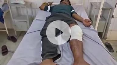 मुरादाबाद: कटघर पुलिस की शोभित ठाकुर की हत्या करने वाले दो हत्यारों के साथ मुठभेड़, दोनों के पैर में लगी गोली, अस्पताल में भर्ती