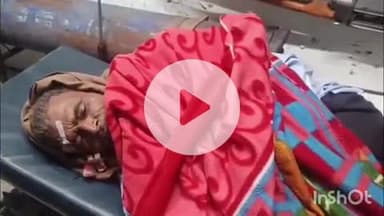 कोल: अकराबाद में मोपेड सवार राज मिस्त्री की मोपेड को तेज गति से बाइक चला रहे दो युवकों ने मारी टक्कर, हादसे में दो लोग घायल