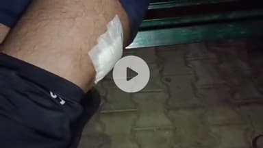 लाडपुरा: कोटा के उद्योग नगर में झगड़े के दौरान बीच-बचाव करने आए युवक पर चाकू से हमला, एमबीएस अस्पताल में भर्ती, उपचार जारी