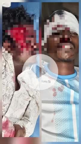 रातू: रातु झखरा टांड में ऑटो की चपेट में आने से बाइक सवार दो युवक घायल!